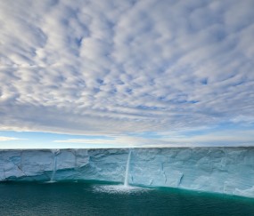 怀孕初期下腹有麻酥酥（怀孕初期下腹部丝丝疼）